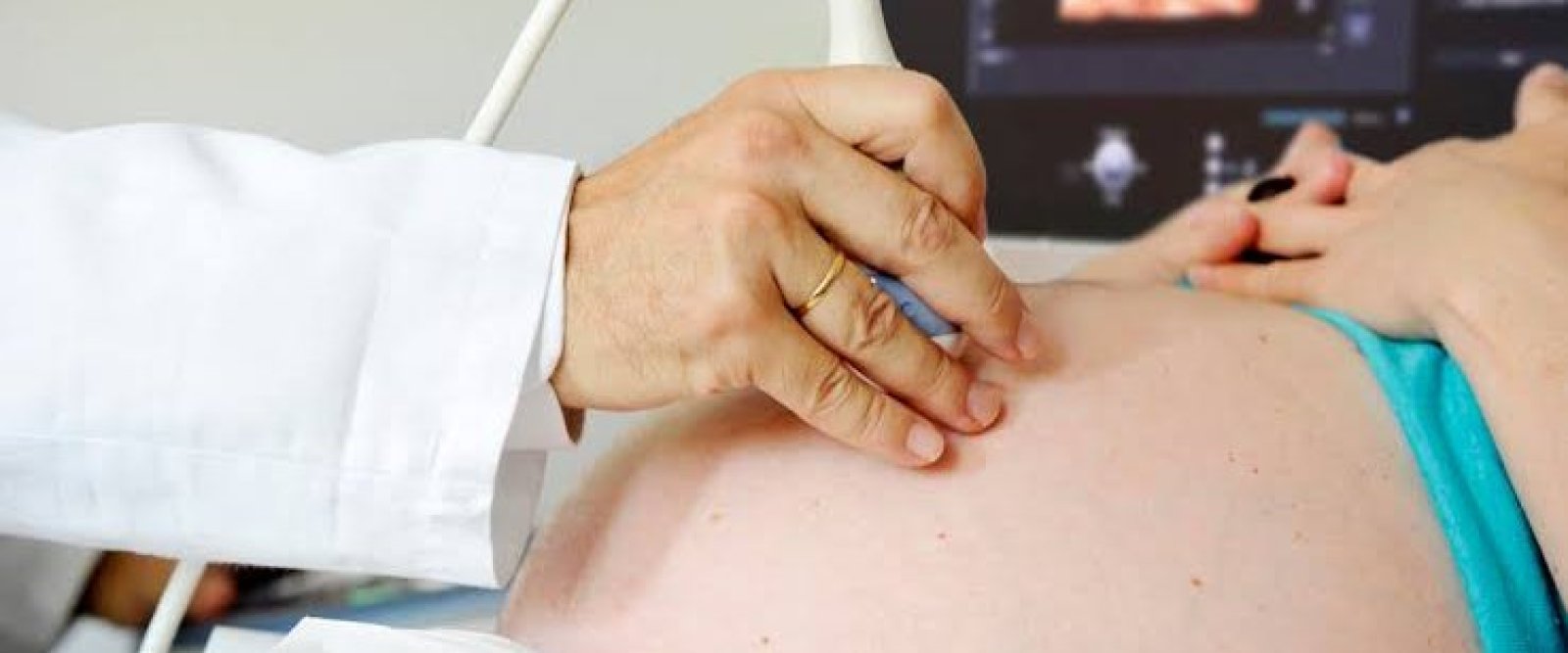 Proyecto de ley busca exigir escuchar latidos fetales antes de acceder al aborto en dos causales legales